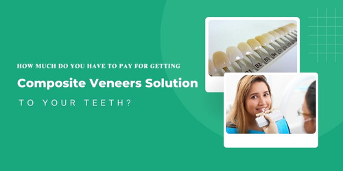 How much do you have to pay for getting composite veneers solution to your teeth.jpg