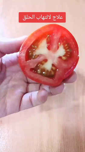 UWNxaNII3tPe FXS.jpg