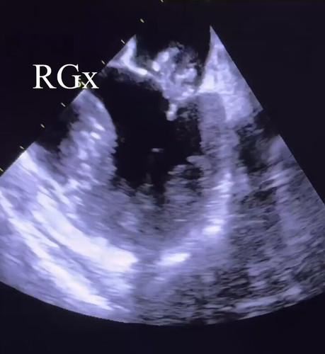 0tWUMx3M Z943F5V.jpg