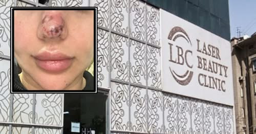 1903436011551005308?url=https%3A%2F%2Fstatic.cdnsb.net%2Fqaynar s3%2F2025 06%2F96af6ae1db326800f560d.jpg