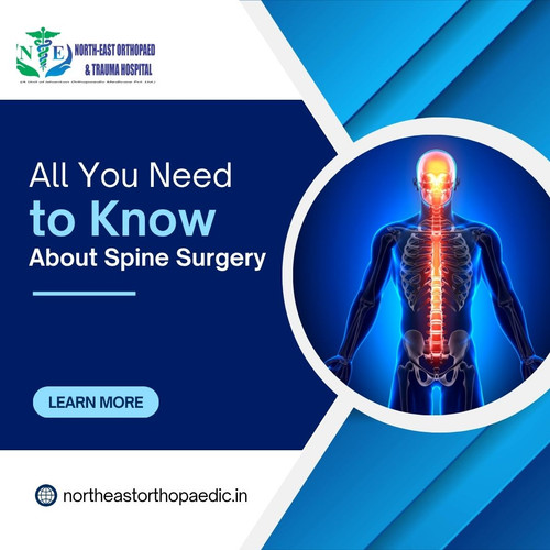 All You Need to Know About Spine Surgery.jpg