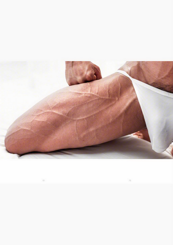 Veins1 037.png