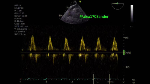 Ep21F7C m5hJ DUA.jpg