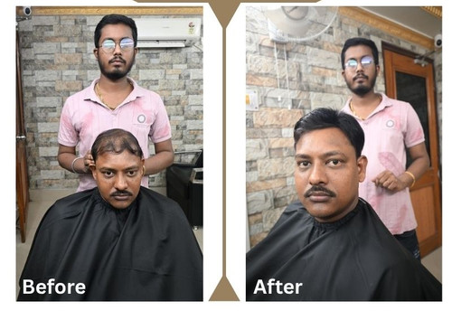 Hair Wigs Services Kolkata - Hair Fixing Service Kolkata.jpg