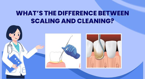 Difference between Scaling and Cleaning - Advance Dental Clinic.jpg