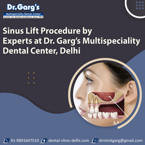 Sinus Lift Procedure by Experts at Dr. Garg’s Multispeciality Dental Center, Delhi.jpg