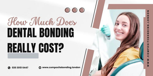 How Much Does Dental Bonding Really Cost A Candid Breakdown.jpg