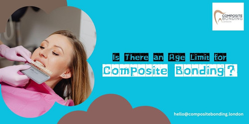 Is There an Age Limit for Composite Bonding Let’s Talk About It.jpg