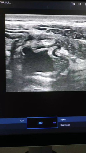 kWDW0U1bnc3 TWgf.jpg