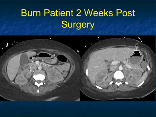 mdParb fnWBALWwr.jpg