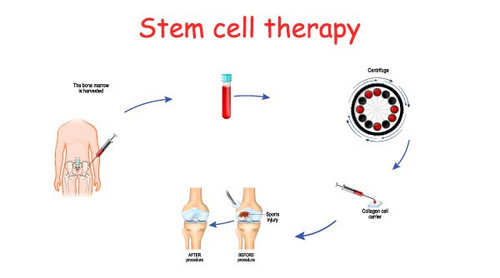 stem cell therapy.jpg