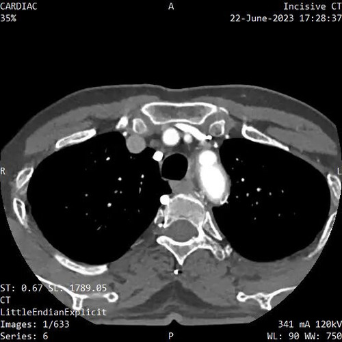 r0t89EPYRpT k5VS.jpg