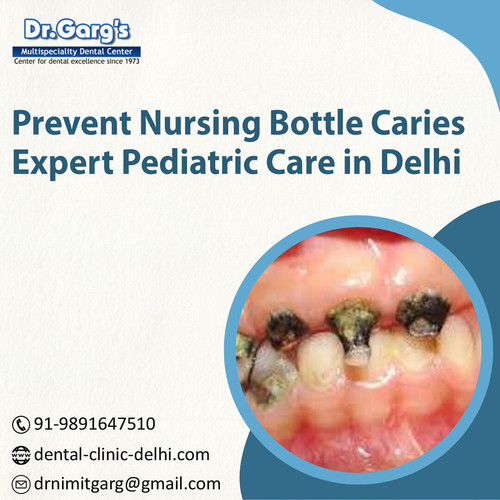 Prevent Nursing Bottle Caries – Expert Pediatric Care in Delhi.jpg