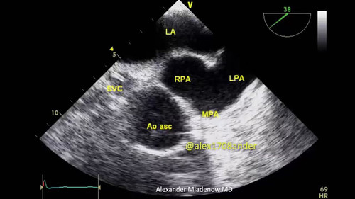RW6 d2D qMx40oSH.jpg