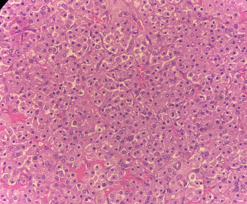 GuxcIpKXYAE1L N.jpg