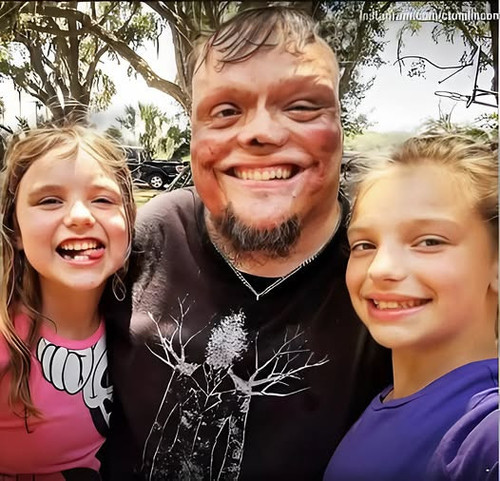 499451402 122161835990563820 8703651230263978390 n.jpg?stp=dst jpg p526x296 tt6& nc cat=100&ccb=1 7&.jpg