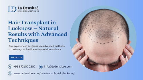 Hair Transplant in Lucknow – Natural Results with Advanced Techniques.jpg