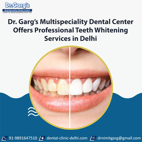 Dr. Garg’s Multispeciality Dental Center Offers Professional Teeth Whitening Services in Delhi.jpg