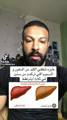 q3Ws RhAPRrByuxK.jpg
