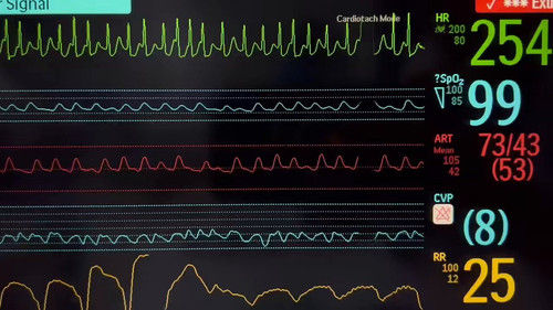 mCHxv89k1o tAS 2.jpg