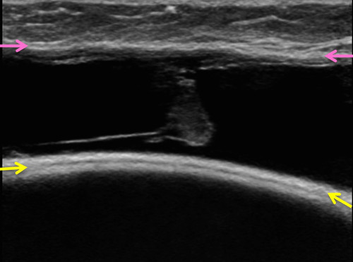 Gu5vzGjWYAAiwmK.jpg