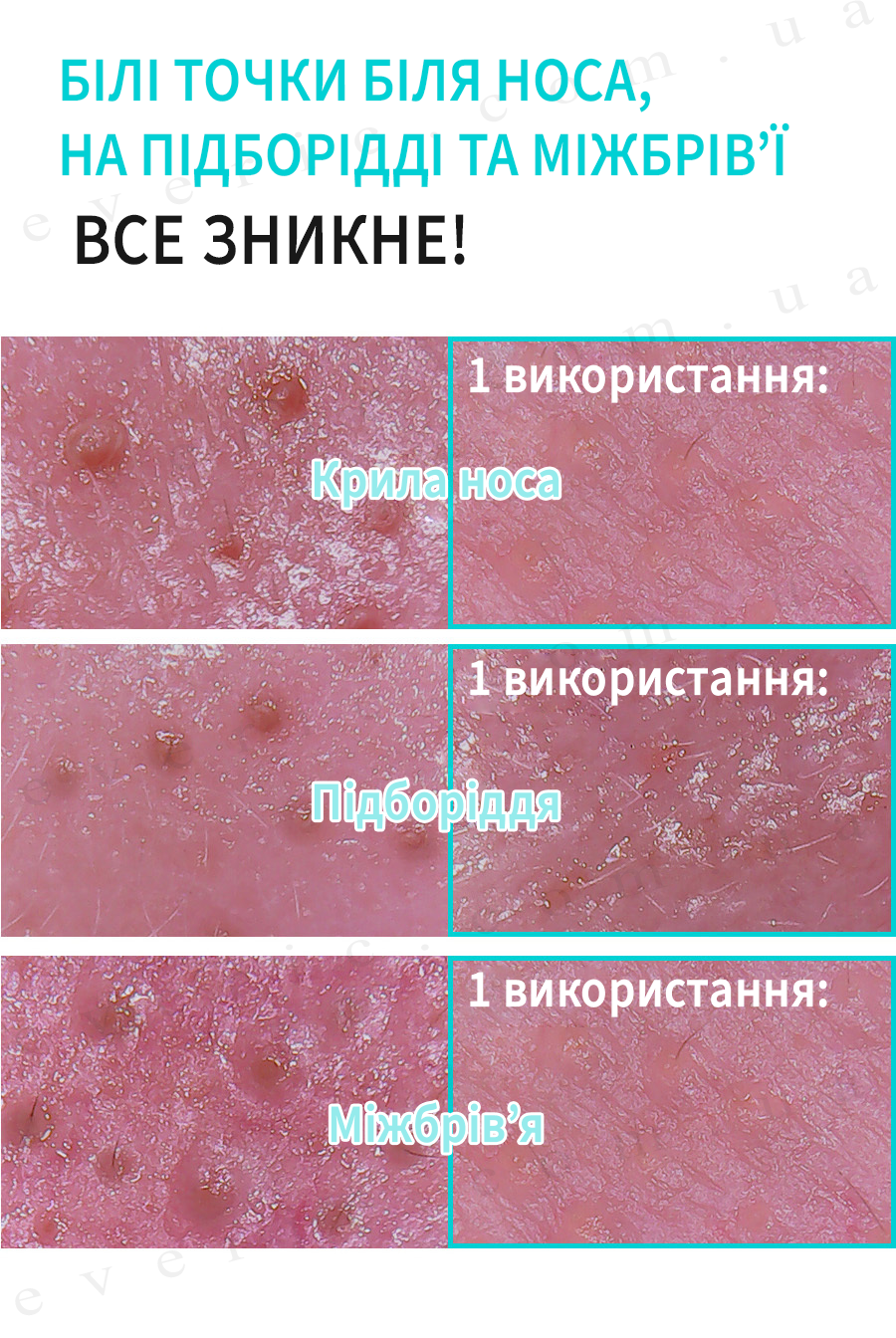14 копия