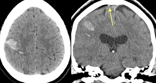 GvD3q5oWEAA LZm?format=jpg.jpg