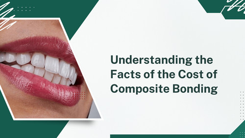 Understanding the Facts of the Cost of Composite Bonding.jpg