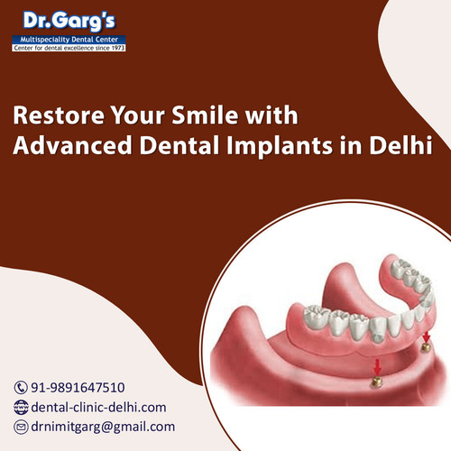 Restore Your Smile with Advanced Dental Implants in Delhi.jpg