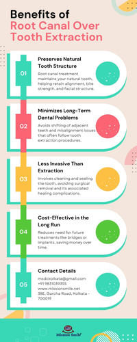 Benefits of Root Canal Over Tooth Extraction.jpg