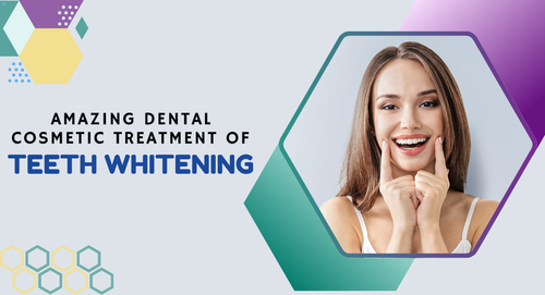 Amazing-dental-cosmetic-treatment-of-teeth-whitening.png