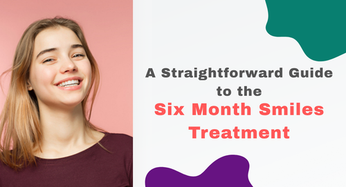 A-Straightforward-Guide-to-the-Six-Month-Smiles-Treatment.png