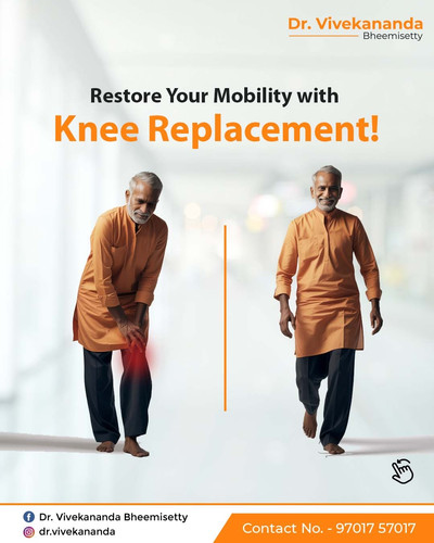Best total Knee Replacement Surgeon Hyderabad.jpg
