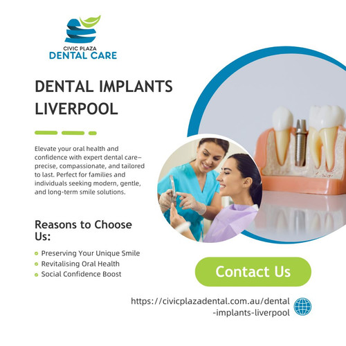 Dental Implants in Liverpool Restoring Oral Architecture with Precision Built Permanence.jpg