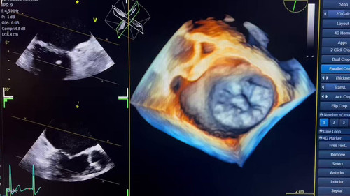 TpC EMPeOPYHEQOX.jpg