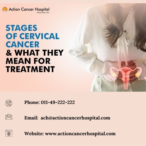 Stages of Cervical Cancer and What They Mean for Treatment.jpg