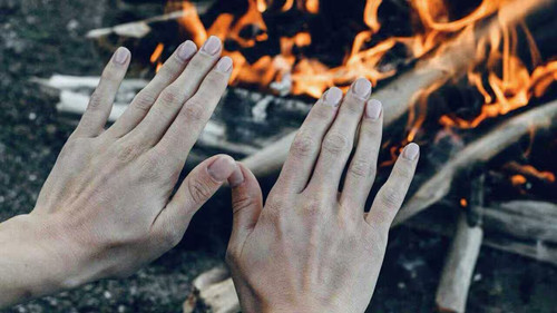 raynaud2509.jpg