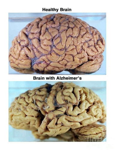 GvG5VAFacAAJTPD.jpg