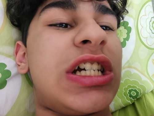 1000093242.jpg