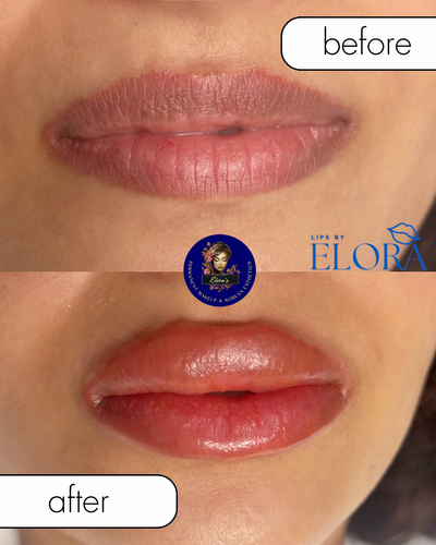 Best Dark lip Correction Before After.png