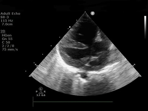 nt LYqW7keSu7ViY.jpg