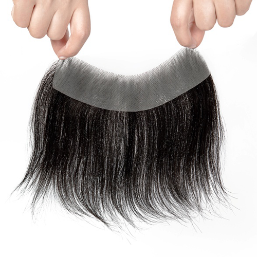 How does a partial frontal hair system work.png