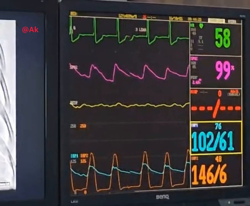 F4iuZT1U IDIYKbz.jpg