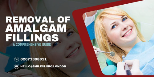 A Comprehensive Guide on the Removal of Amalgam Fillings.jpg
