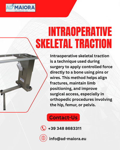 Intraoperative skeletal traction.png