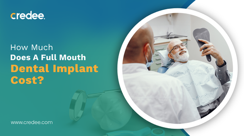 How Much Does A Full Mouth Dental Implant Cost.png