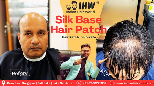 Hair Patch in Kolkata | Indian Hair World Salt Lake.jpg