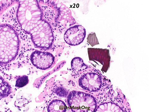 Gtp8Mz4WIAEMPvw.jpg