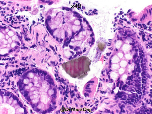 Gtp8TsTWsAA94iD.jpg