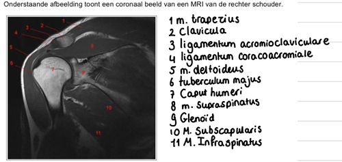 cf62ba31a13f.png